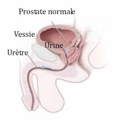 Qu'est-ce que la prostate